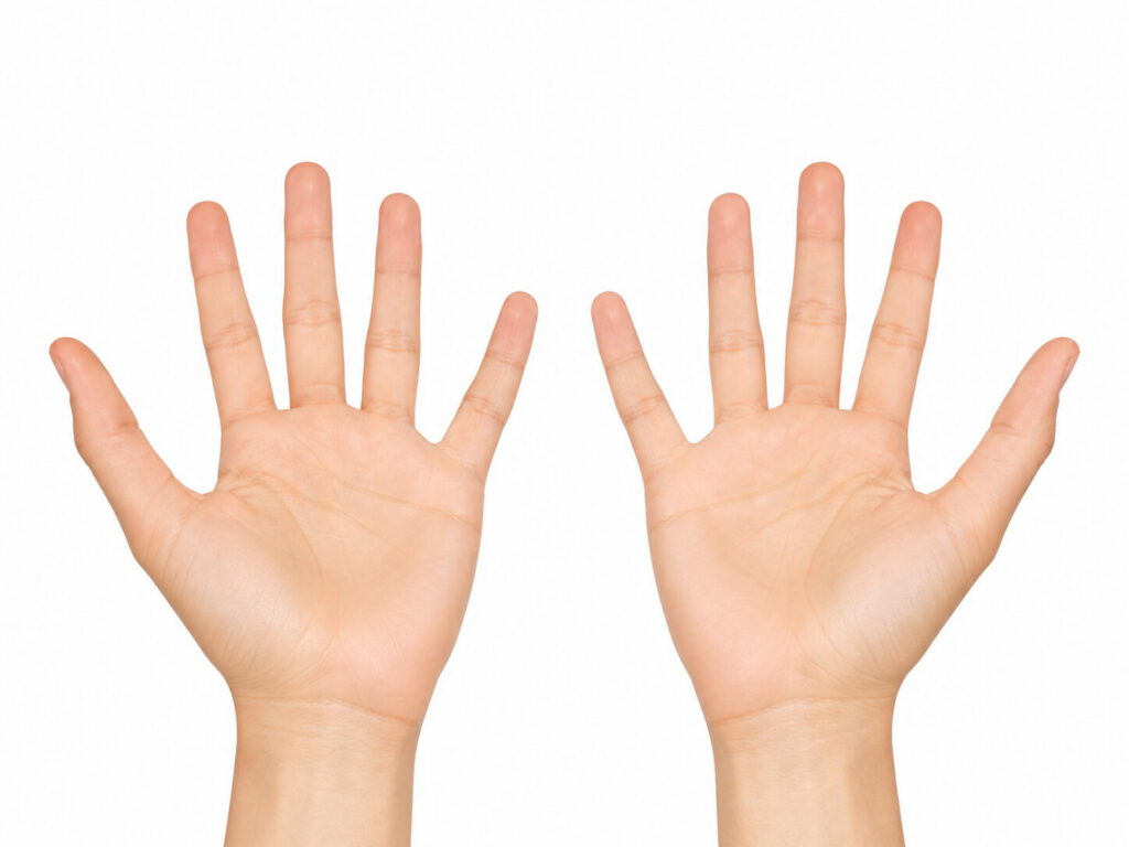 Botox treatment for sweaty hands