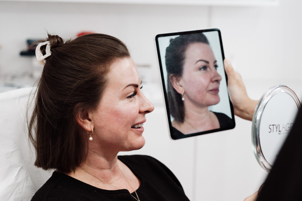 Dermal filler consultations