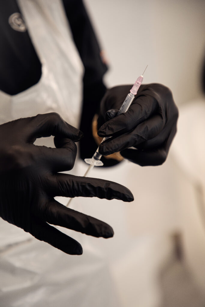 Excessive sweating treatment using Botox