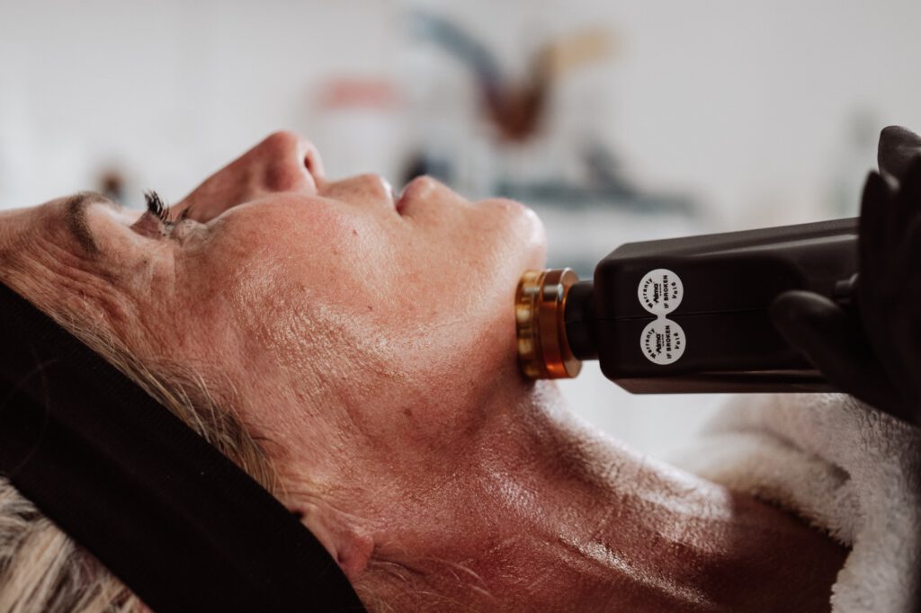 Laser resurfacing treatment in Essex