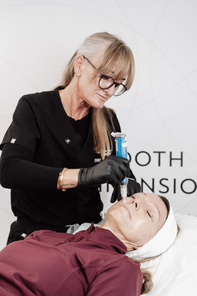 Microneedling in Essex