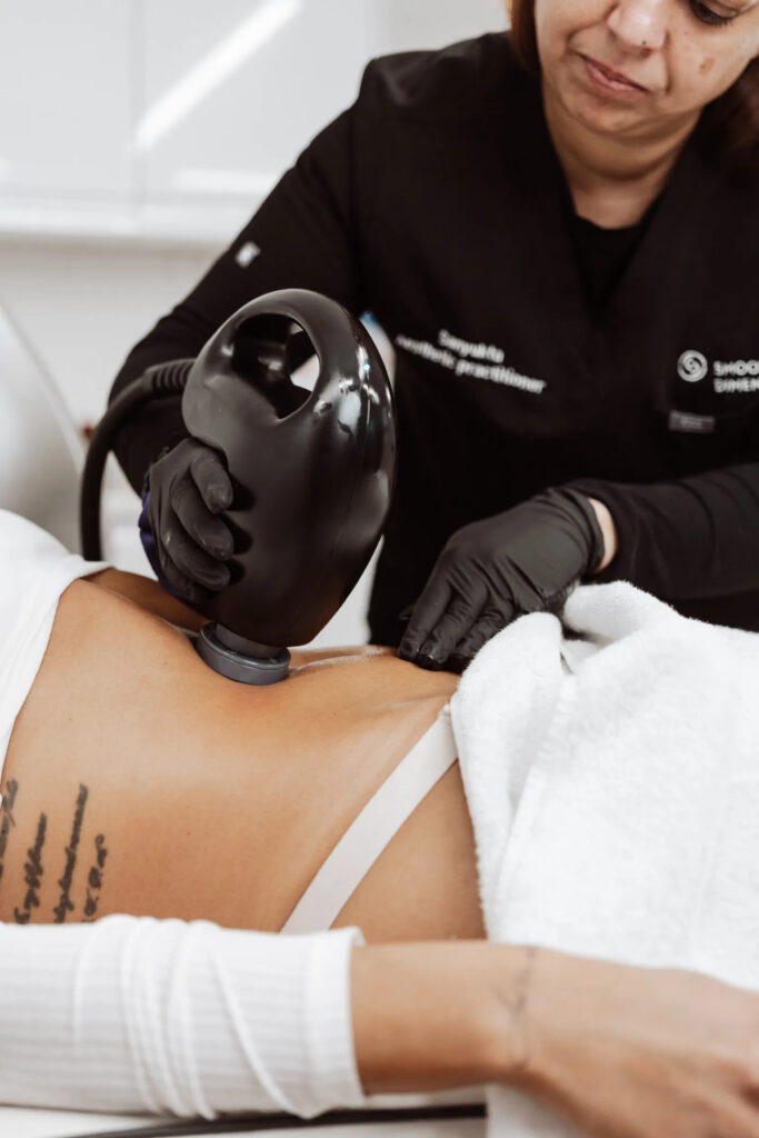 RF body skin tightening treatment