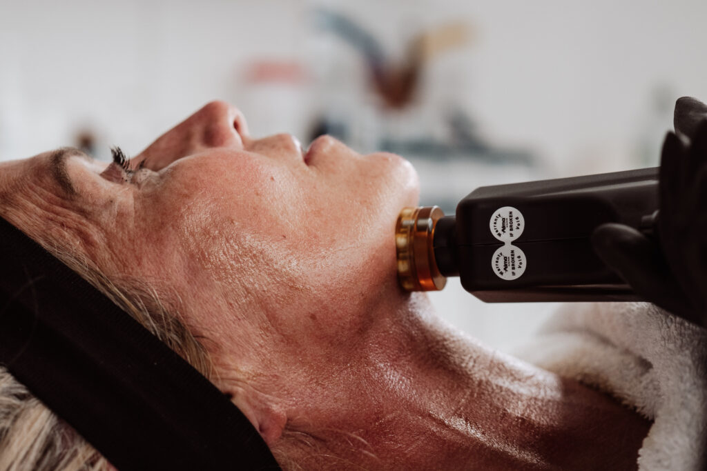 RF treatment for facial skin laxity