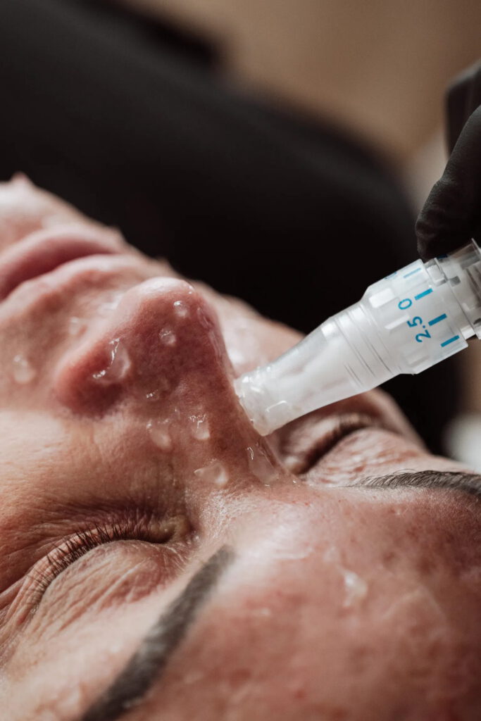 SkinPen microneedling clinic