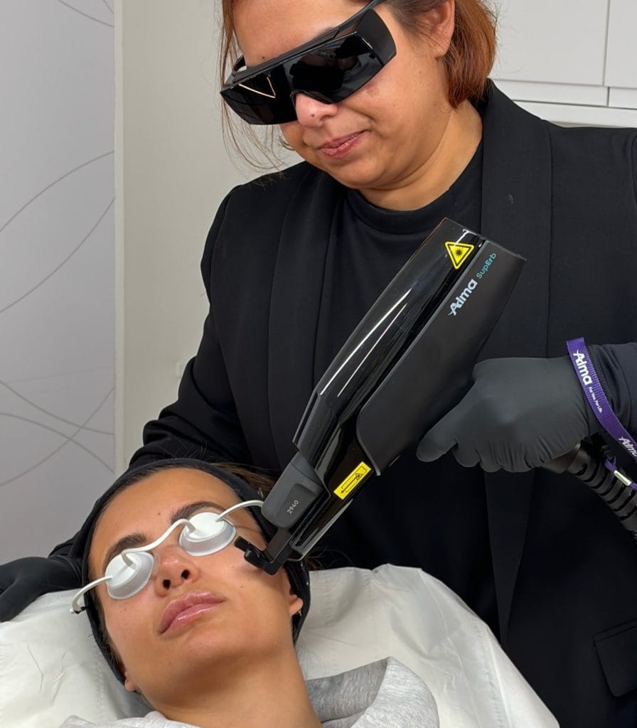 Skin resurfacing with Alma laser